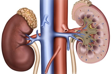 Nephrectomy or Kidney Removal Surgery: All you need to know 