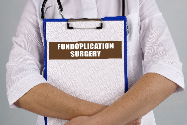 Fundoplication Laparoscopy Surgery - Solution for GERD Issues