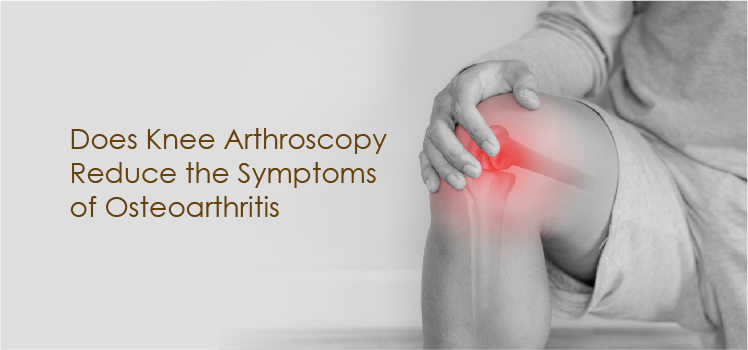 Does Knee Arthroscopy Reduce the Symptoms of Osteoarthritis