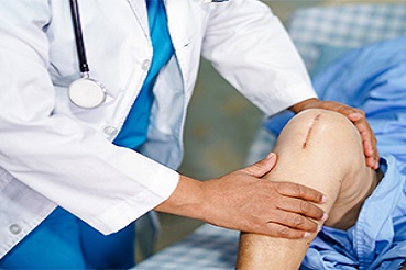 7 Common Myths Busted: Facts on Knee Replacement Surgery
