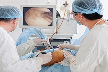 Questions You Must Ask Your Doctor Before Arthroscopy Surgery