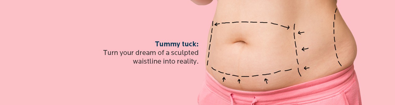 Tummy tuck: Turn your dream of a sculpted waistline into reality.