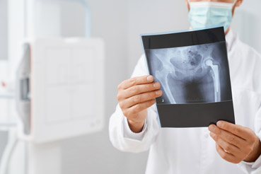 Are you a good candidate for Hip Replacement Surgery?