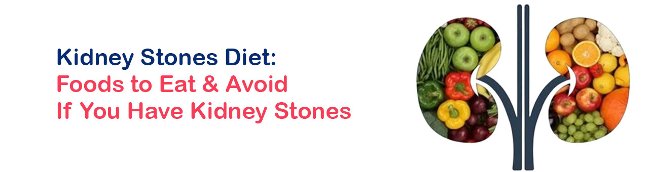 Kidney Stones Diet: Foods to Eat & Avoid If You Have Kidney Stones