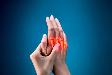 Rheumatoid Arthritis – Causes Symptoms and Treatment
