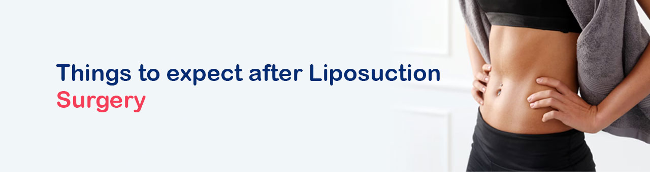 Things to expect after Liposuction Surgery
