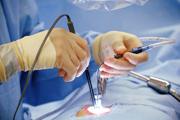 Things to Keep in Mind While Choosing the Right Cardiac Surgeon