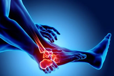 What are the Different Types and Treatments of Arthritis? 