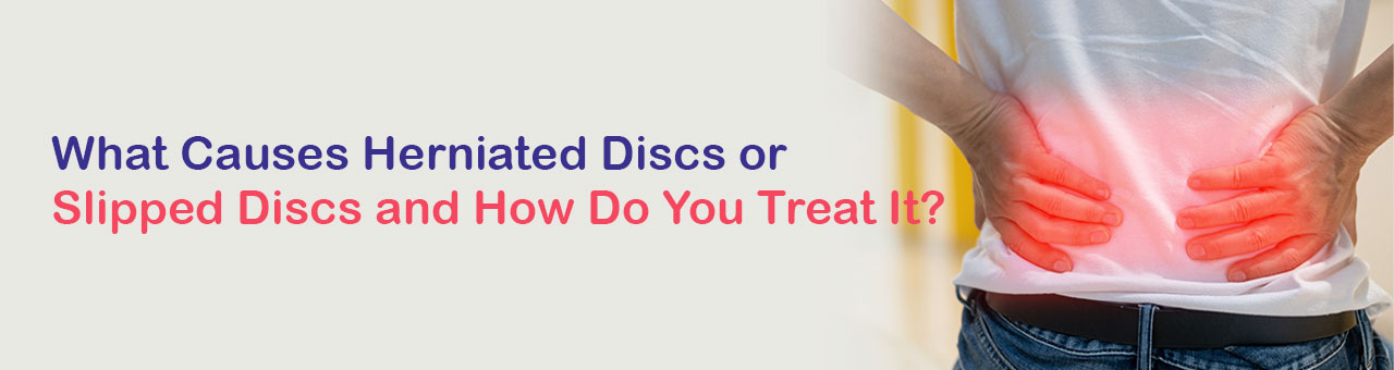 What Causes Herniated Discs or Slipped Discs and How Do You Treat It?