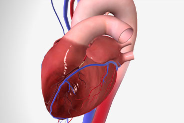   Can Heart Disease be Reversed? What You Need to Know?
